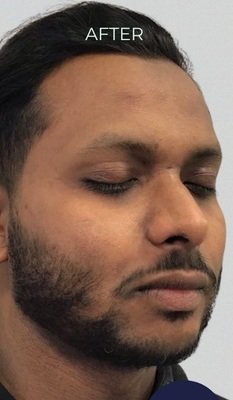 After Bright & Glowing